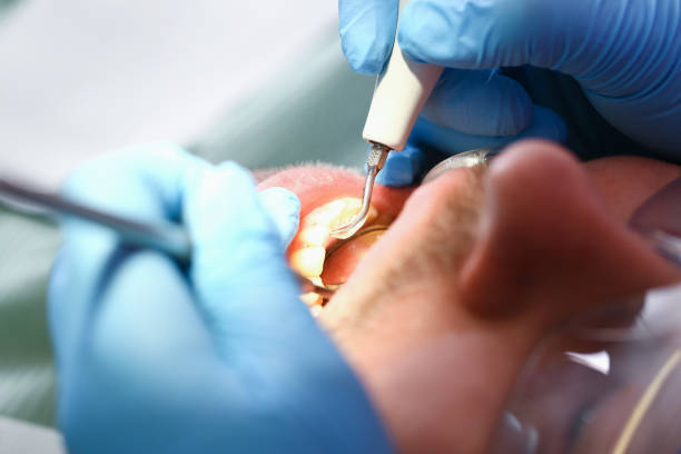 Best Tooth Infection Emergency Dentist  in Shortsville, NY