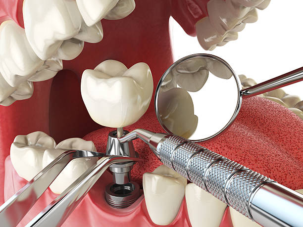 Best Knocked-Out Tooth Emergency  in Shortsville, NY